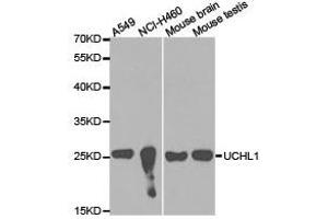 Western Blotting (WB) image for anti-Ubiquitin Carboxyl-terminal Esterase L1 (Ubiquitin Thiolesterase) (UCHL1) antibody (ABIN1875266) (UCHL1 Antikörper)
