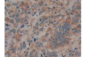 Immunohistochemistry (IHC) image for anti-Prolactin Receptor (PRLR) (AA 25-234) antibody (ABIN7443311)