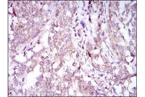 Immunohistochemistry (IHC) image for anti-Sequestosome 1 (SQSTM1) (AA 232-356) antibody (ABIN1846090) (SQSTM1 Antikörper  (AA 232-356))