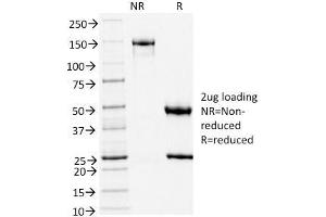 SDS-PAGE Analysis Purified TLE1 Mouse Monoclonal Antibody (TLE1/2051).
