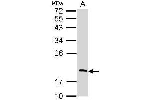 WB Image Sample (30 ug of whole cell lysate) A: Raji 12% SDS PAGE antibody diluted at 1:1000 (RGS13 Antikörper)