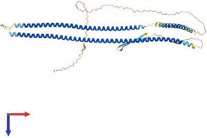 KRT12 Protein (AA 1-487) (His tag)