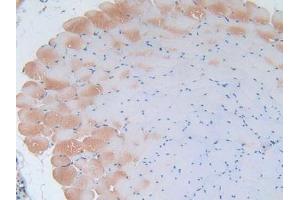 IHC-P analysis of Mouse Skeletal Muscle Tissue, with DAB staining. (IL-2 Antikörper  (AA 10-169))