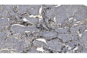 IHC analysis of L/CMBL using anti-L/CMBL antibody (ABIN7599150). (CMBL Antikörper  (AA 1-246))