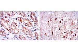 Immunohistochemical analysis of paraffin-embedded stomach tissues (left) and brain tissues (right) using OTX2 mouse mAb with DAB staining. (OTX2 Antikörper)