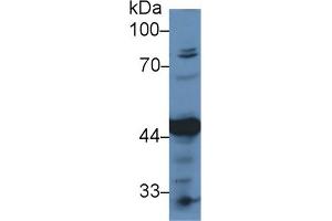 Western Blotting (WB) image for anti-Pyruvate Dehydrogenase (Lipoamide) alpha 1 (PDHA1) (AA 30-390) antibody (ABIN7432574)