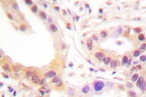 Image no. 1 for anti-V-Ets erythroblastosis Virus E26 Oncogene Homolog 1 (Avian) (ETS1) antibody (ABIN272023) (ETS1 Antikörper)