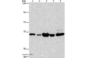 Western blot analysis of Human bladder carcinoma and brain malignant glioma tissue, A172 cell, human fetal brain tissue and hela cell, using PDE4D Polyclonal Antibody at dilution of 1:450 (PDE4D Antikörper)