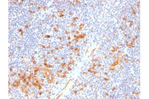 Formalin-fixed, paraffin-embedded human Tonsil stained with IL3RA / CD123 Rabbit Recombinant Monoclonal Antibody (IL3RA/2947R).