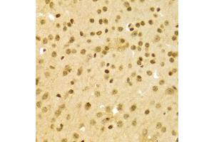 Immunohistochemistry of paraffin-embedded mouse brain using DKC1 Antibody (ABIN5970956) at dilution of 1/100 (40x lens). (DKC1 Antikörper)