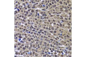 Immunohistochemistry of paraffin-embedded mouse cancer using GPS1 antibody at dilution of 1:100 (x400 lens). (GPS1 Antikörper)