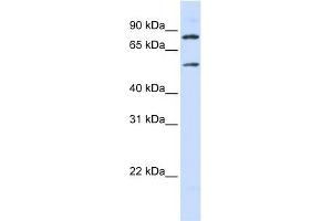SLC27A4 antibody used at 1 ug/ml to detect target protein. (SLC27A4 Antikörper)