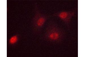 Immunofluorescence (fixed cells) (IF/ICC) image for anti-Myc Proto-Oncogene protein (MYC) (pSer62) antibody (ABIN6255431)
