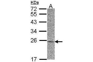 WB Image Sample (30 ug of whole cell lysate) A: HCT116 12% SDS PAGE antibody diluted at 1:500 (Adenylate Kinase 1 Antikörper)