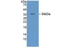 Figure. (ANTXR2 Antikörper  (AA 34-318))
