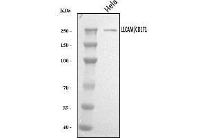 Western blot analysis of L1CAM using anti-L1CAM antibody (ABIN7600528).