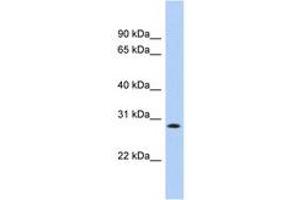 Image no. 1 for anti-Potassium Channel Tetramerisation Domain Containing 17 (KCTD17) (AA 179-228) antibody (ABIN6742565) (KCTD17 Antikörper  (AA 179-228))