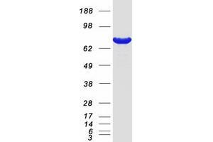 Western Blotting (WB) image for Protein Arginine Methyltransferase 7 (PRMT7) protein (Myc-DYKDDDDK Tag) (ABIN2729676)