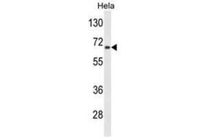 Western blot analysis of AGXT2 Antibody (C-term) in Hela cell line lysates (35 µg/lane). (AGXT2 Antikörper  (C-Term))