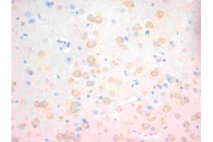 Immunohistochemical staining of CHRNA1 on formalin fixed, paraffin embedded rat brain with CHRNA1 polyclonal antibody .