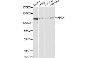 Western blot analysis of extracts of various cell lines, using AP2A1 antibody (ABIN2561135) at 1:1000 dilution. (alpha Adaptin Antikörper)