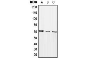 Western blot analysis of ARHGEF5 expression in HEK293T (A), SP2/0 (B), H9C2 (C) whole cell lysates.