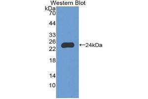 Western blot analysis of the recombinant protein. (NCF2 Antikörper  (AA 355-526))