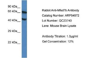 Western Blotting (WB) image for anti-Feline Leukemia Virus Subgroup C Cellular Receptor 1 (FLVCR1) (Middle Region) antibody (ABIN2785982)