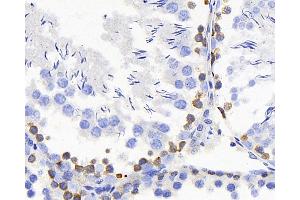 Immunohistochemistry analysis of paraffin-embedded rat testis using TSC22D3 Polyclonal Antibody at dilution of 1:300. (TSC22D3 Antikörper)