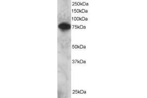 Image no. 1 for anti-SET Domain and Mariner Transposase Fusion Gene (SETMAR) (AA 671-684) antibody (ABIN297642) (SETMAR Antikörper  (AA 671-684))