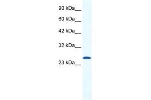 Western Blotting (WB) image for anti-Calcium Channel, Voltage-Dependent, gamma Subunit 6 (CACNG6) antibody (ABIN2461142)