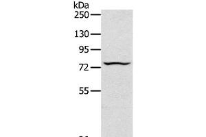 Western Blot analysis of Jurkat cell using TAP2 Polyclonal Antibody at dilution of 1:200 (TAP2 Antikörper)