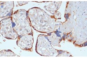 Immunohistochemistry of paraffin-embedded Human placenta using PDGFR beta Polyclonal Antibody at dilution of 1:100 (40x lens). (PDGFRB Antikörper)