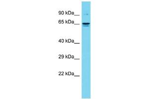 Host: Rabbit Target Name: DTX4 Sample Type: Fetal Kidney lysates Antibody Dilution: 1.