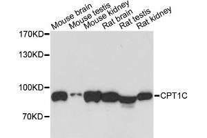 Western blot analysis of extracts of various cell lines, using CPT1C antibody. (CPT1C Antikörper)
