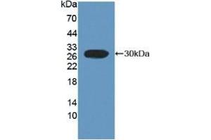 Detection of Recombinant FcaR, Rat using Polyclonal Antibody to Fc Fragment Of IgA Receptor (FcaR) (FCAR Antikörper  (AA 51-280))