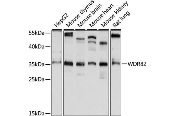 WDR82 Antikörper  (AA 174-313)