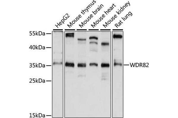 WDR82 抗体  (AA 174-313)