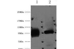 Western Blot analysis of 1) Hela, 2) 293T cells using ABCB5 Monoclonal Antibody at dilution of 1:2000. (ABCB5 Antikörper)