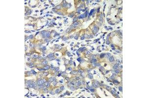 Immunohistochemistry (Paraffin-embedded Sections) (IHC (p)) image for anti-4-Aminobutyrate Aminotransferase (ABAT) (AA 29-300) antibody (ABIN6136330)