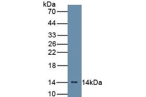 Detection of Recombinant CFB, Mouse using Polyclonal Antibody to Complement Factor B (CFB) (Complement Factor B Antikörper  (AA 32-157))