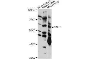 Western blot analysis of extracts of various cell lines, using CBLL1 antibody (ABIN6292394) at 1:1000 dilution. (CBLL1 Antikörper)