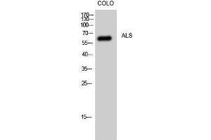 Western Blotting (WB) image for anti-Superoxide Dismutase 1, Soluble (SOD1) (Internal Region) antibody (ABIN3183256) (SOD1 Antikörper  (Internal Region))