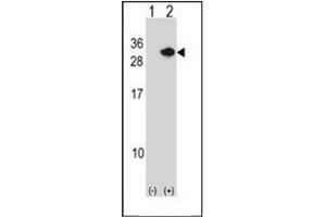 Western blot analysis of RCAN1 (arrow) using Calcipressin-1 Antibody . (RCAN1 Antikörper  (N-Term))