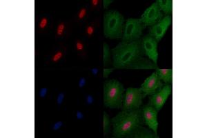 ABIN6258629 and ABIN6275742 staining  cells by IF/ICC. (Elf4 Antikörper  (Internal Region))