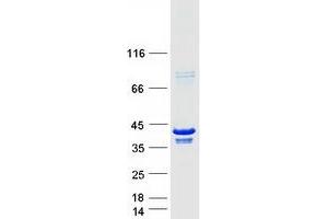 Western Blotting (WB) image for Parvin, gamma (PARVG) (Transcript Variant 1) protein (Myc-DYKDDDDK Tag) (ABIN2728301)