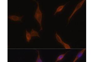 Immunofluorescence analysis of NIH-3T3 cells using MLPH Polyclonal Antibody at dilution of 1:100. (Melanophilin Antikörper)