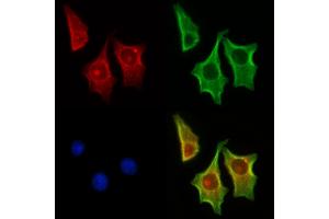 ABIN7094348 and ABIN7098395 staining HepG2 cells by IF/ICC. (MAP1S Antikörper  (Internal Region))