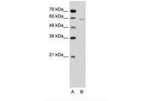 Image no. 1 for anti-Cell Division Cycle 23 (CDC23) (C-Term) antibody (ABIN6736648) (CDC23 Antikörper  (C-Term))