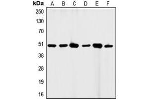 Western blot analysis of CD95 expression in HeLa (A), A431 (B), K562 (C), HL60 (D), mouse brain (E), H9C2 (F) whole cell lysates. (FAS Antikörper  (C-Term))